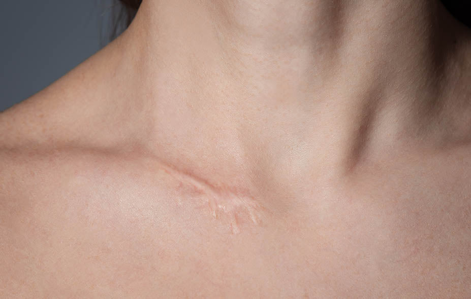 Skin Concerns] How do I fade these scars? They are so dark on my