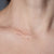 How to Fade and Prevent Scars