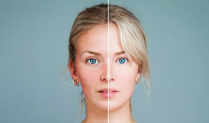 What You Should Know About Skin Inflammation