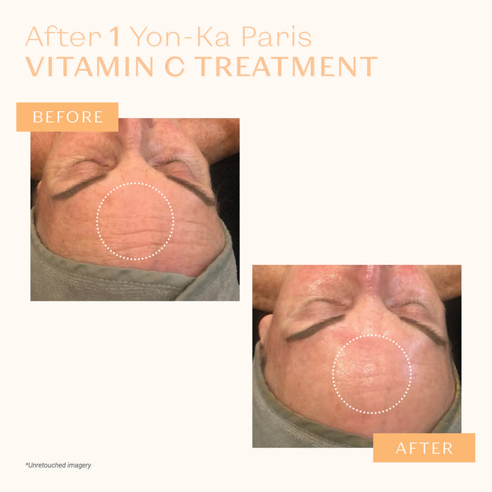 SERUM VITAMINE C