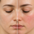 Dry Skin vs Sensitive Skin: How to Tell the Difference