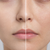 What Causes Dehydrated Skin vs Dry Skin?
