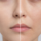 What Causes Dehydrated Skin vs Dry Skin?