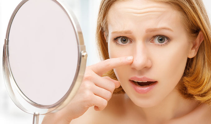 5 Reasons Why You Should Never Pop Your Pimples & What to Do Instead