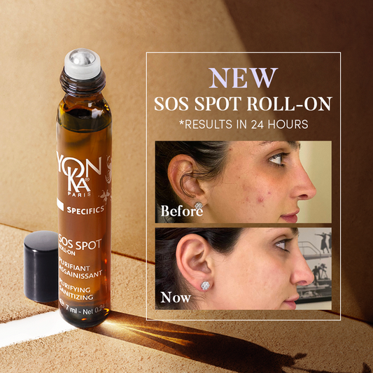 SOS SPOT Roll-On Blemish Treatment