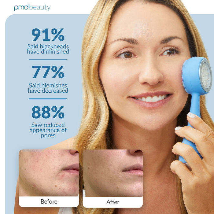 PMD LED Acne Facial Cleansing Device