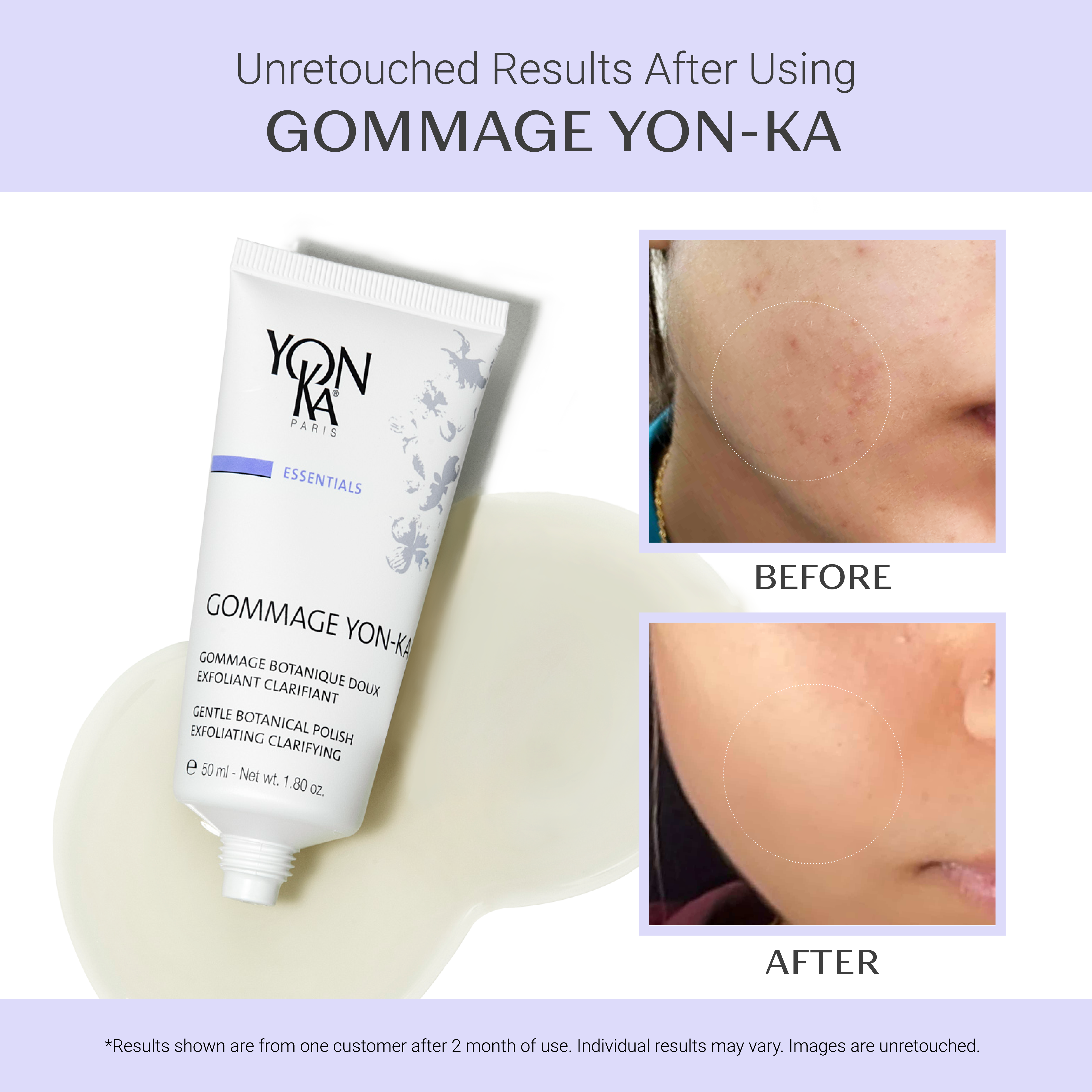 Gommage Yon-Ka