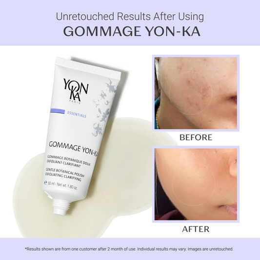 Yon-Ka Exfoliante Suave