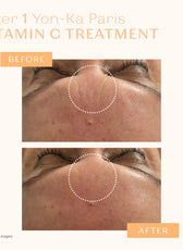 SERUM VITAMINE C 20%