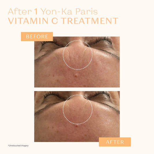 SERUM VITAMINE C