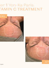 SERUM VITAMINE C 20%